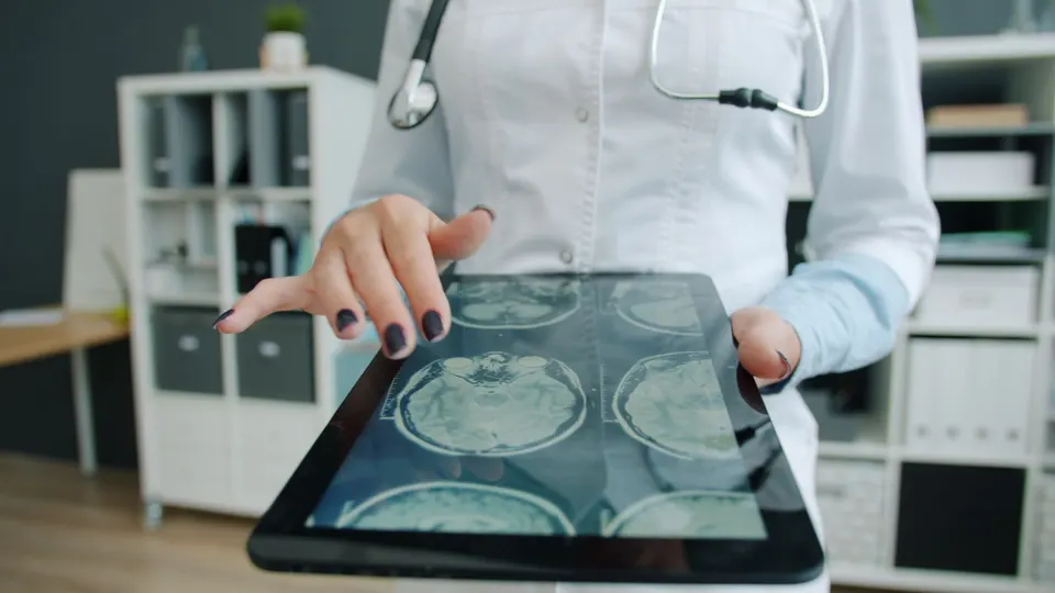 Clinician reviewing brain scans on a tablet